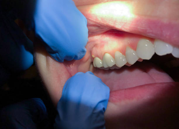 Best Broken or Cracked Tooth Emergency Dentist in Gorevle, IL