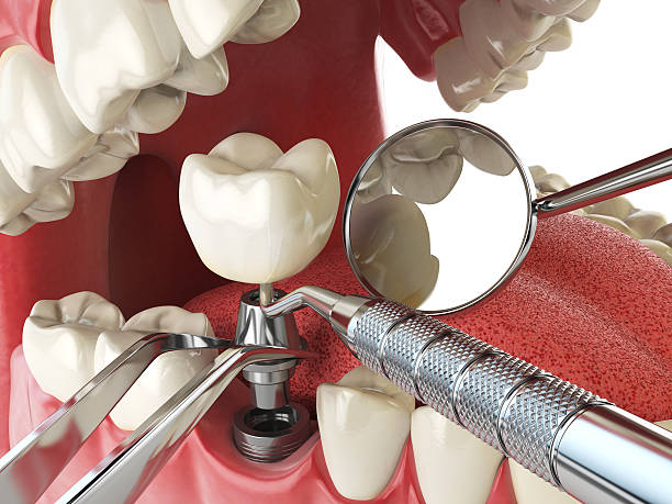 Best Weekend Emergency Dentist in Gorevle, IL