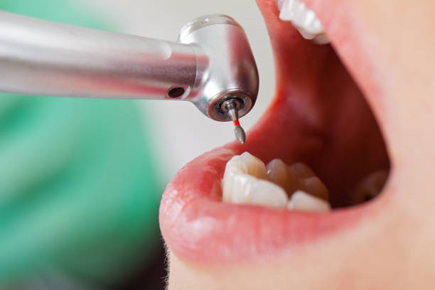 Best Emergency Dental Services for Seniors in Gorevle, IL